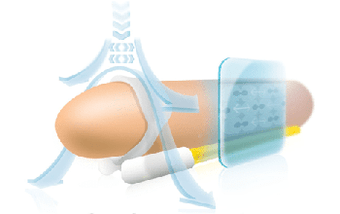 Luzatzailearen luzapenaren funtzionamendu-printzipioa